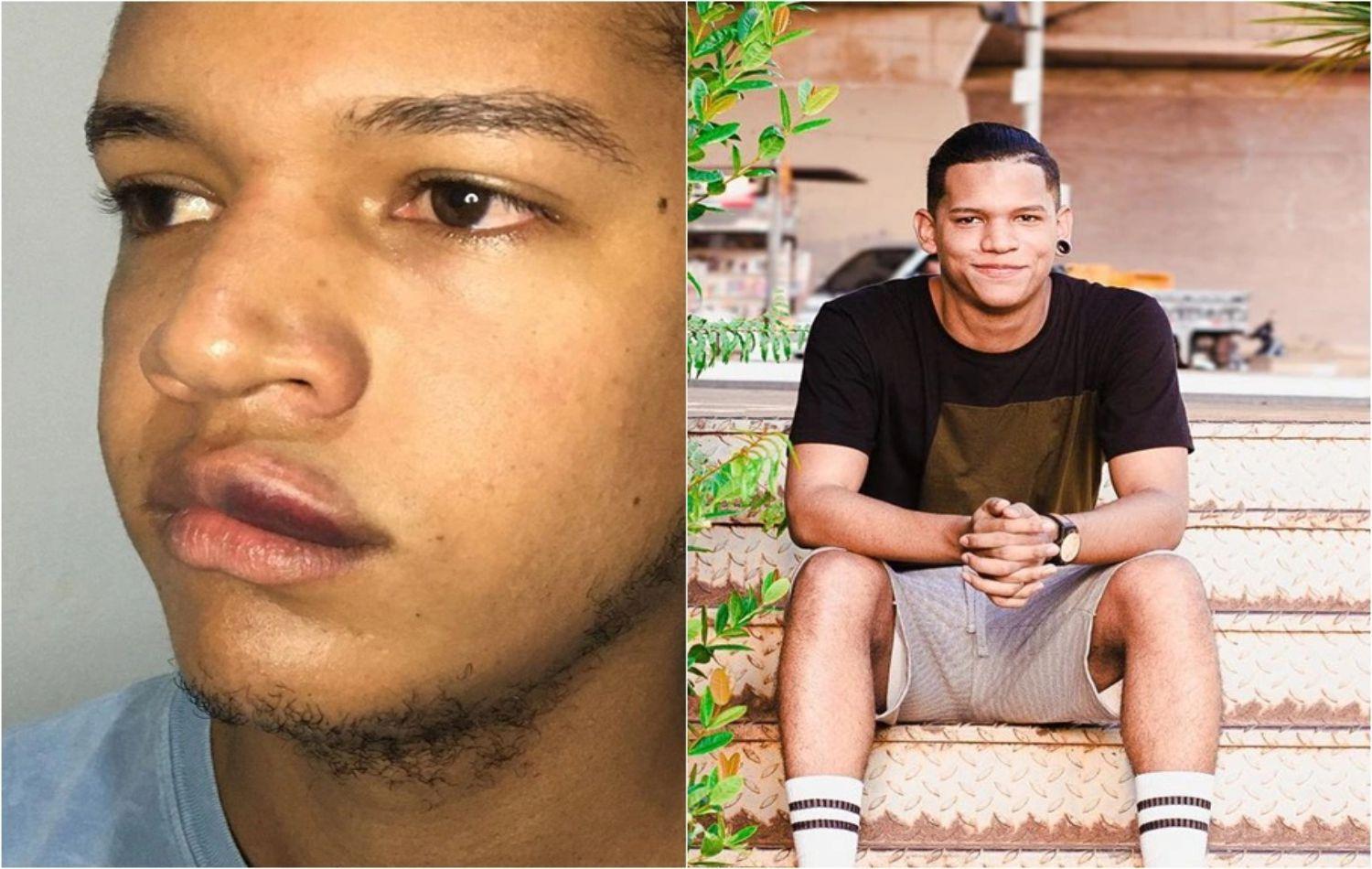 Fotógrafo denuncia que foi espancado na boate Apolo 11 em Teresina