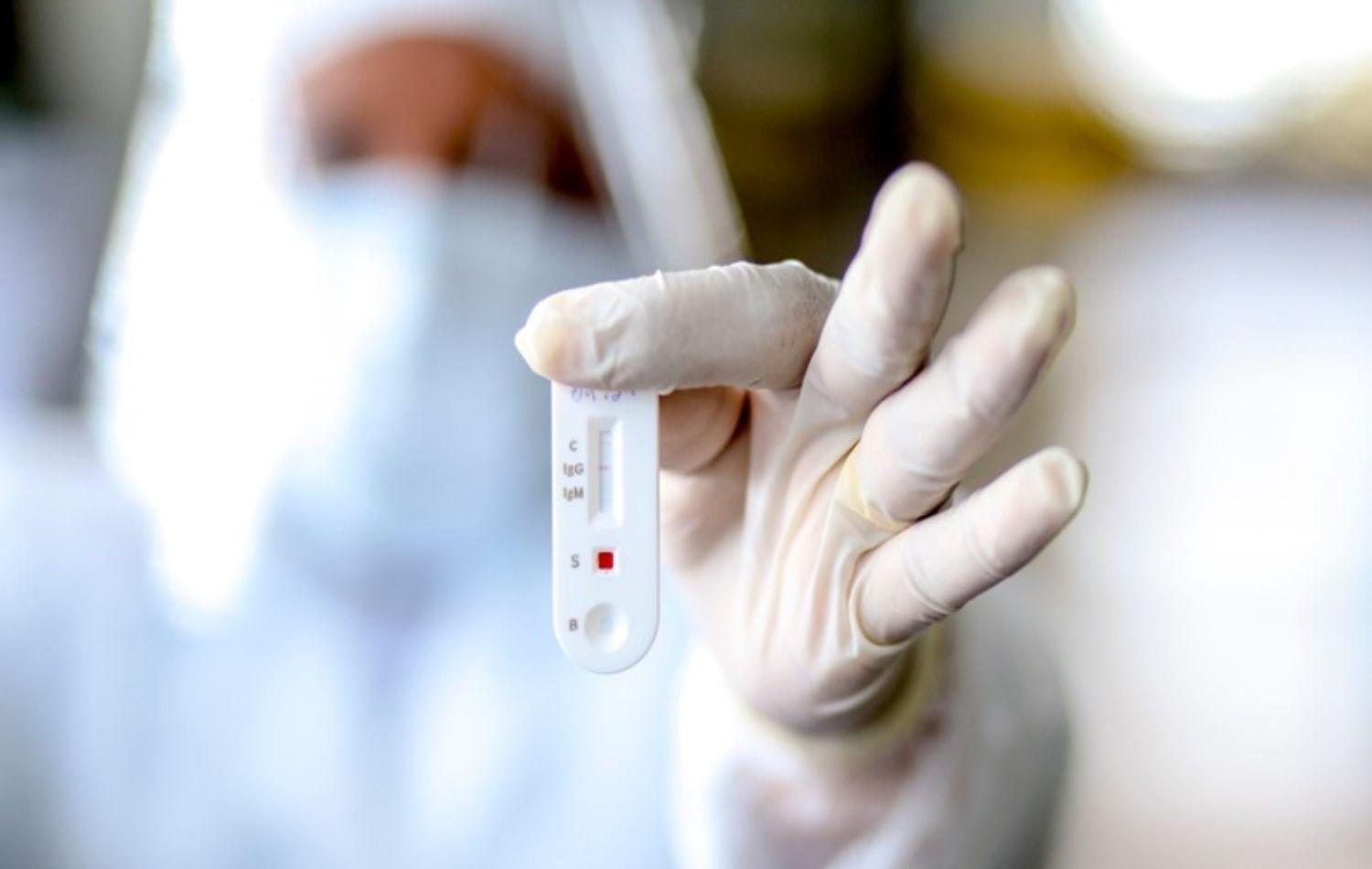 Teresina está há sete dias sem registrar óbitos por Covid-19, aponta Painel da FMS